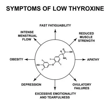 Symptoms of low thyroxine. Thyroxine thyroid hormone. Infographics. Vector Stock Illustration