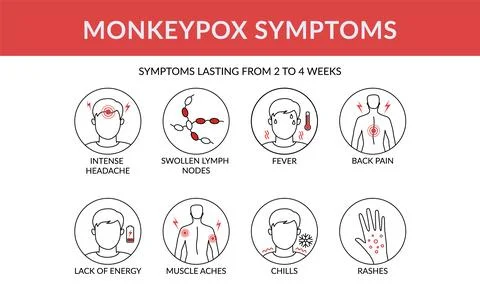 Symptoms of the monkey pox virus infographic. This causes skin infections. Li Stock Illustration