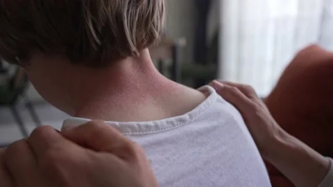 Symptoms of photodermatitis. Mom noticed a rash on the boy's neck. Improper Stockbeeldmateriaal 171313757