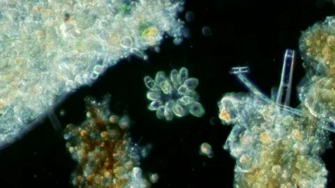 Synura Golden Algae at 20x Under Darkfield Microscopy Stock Footage 336944323