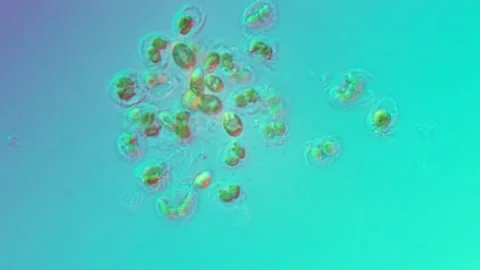 Synura Golden Algae at 50x Under Nomarski DIC Microscopy Stock Footage 336944610