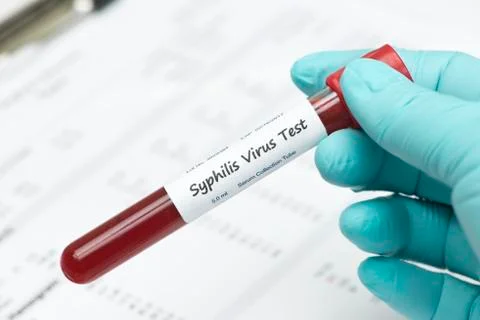 Syphilis Test Panel Stock Photos