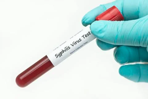 Syphilis Test Panel Foto stock