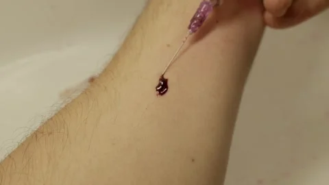 Syringe Needle In Arm With Blood Drop During Injection Process Stock Footage 330274835
