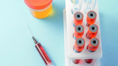 A syringe with a red liquid in it is next to a container of urine Stock-Fotos