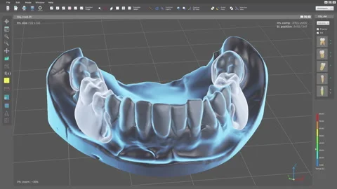 System interface virtually inserting the restoration teeth into the damaged jaw Stock Footage 319268063