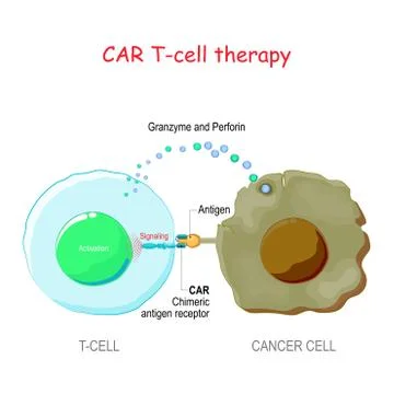 T-cell with Chimeric antigen receptor (CAR t cell) killing of the tumor cell. Stock Illustration