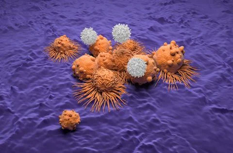 T-cells attack carcinoma cells field in kidney cancer Ilustração Stock