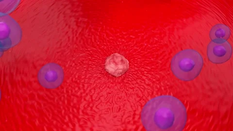 T-cells attack growed mature tissue tumor cancer around plasma cells. Stock Footage 204997917