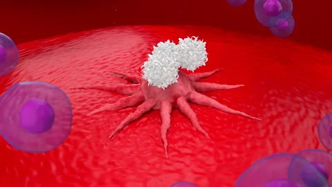 T-cells attack growed tumor cancer 3d render animation Stock Footage 151641903