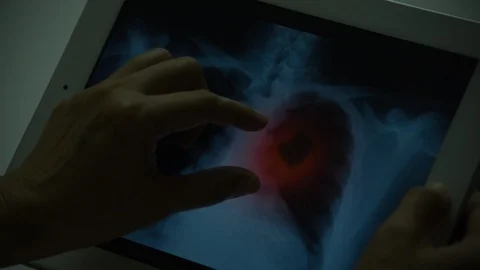 Tablet-1 Stock Footage 98330191
