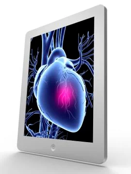 Tablet computer; heart attack artwork 스톡 일러스트