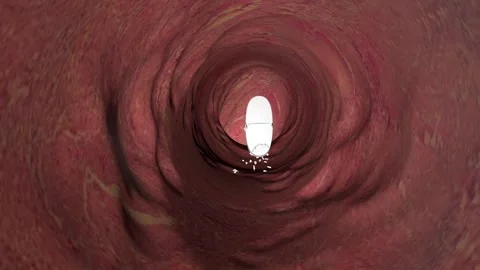 Tablet inside the colon Stock Footage 148836753