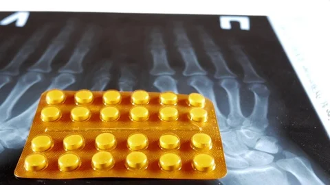 Tablets in a transparent package lie on the x-ray of the hands. Close-up Stock Footage 73827510