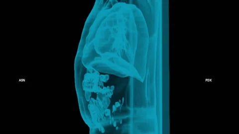 TAC 3D Volume - Chest and Abdomen soft tissue airways - Full HD - ProRes Stock Footage 166204829