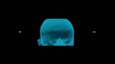 TAC 3D Volume - Skull soft tissue airways - Full HD - ProRes Stock Footage 166204815