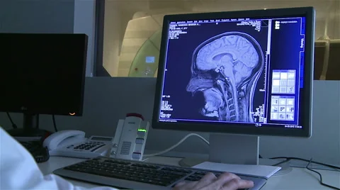 TAC Brain scan. Stock Footage 63364470