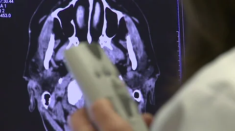 TAC Brain scan. Stock Footage 63364485
