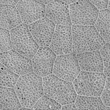 Tadpole Skin - Electron Microscope Stock Photos