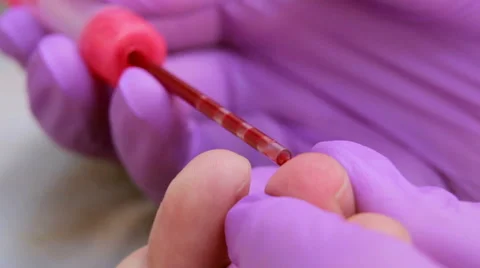 Take blood from a finger Stock Footage 42884992