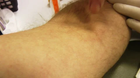 Taking blood sample Stock-Footage 5071440