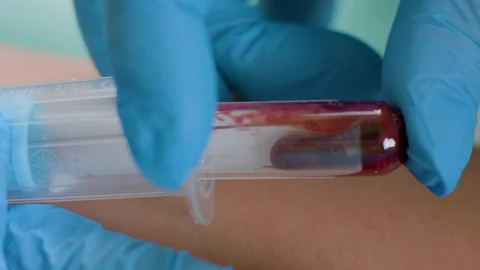 Taking the blood for a test in a laboratory Stock Footage 112217528