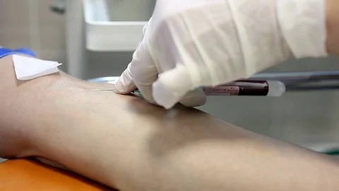 Taking blood tests Stock Footage 70366167