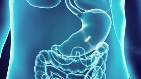 Taking capsules and probiotics: particles diffuse in the stomach Stockbeeldmateriaal 344952354