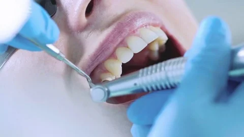 Taking care of the teeth at the dentist. Stock Footage 82064547