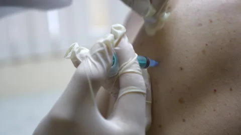 Taking out Injector Stock Footage 148488878