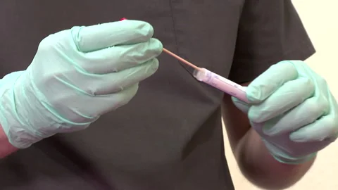 Taking a PCR Corona Virus Sample in a Health Clinic. Video stock 168629148