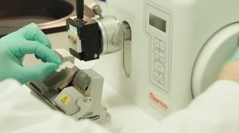 Taking sample from bones Vidéo 37343487