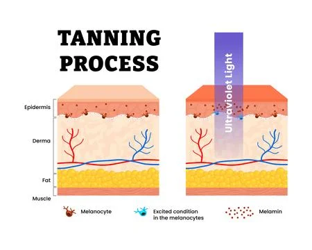 Tanning process skin with ultraviolet light waves touch melanocyte, increas.. Stock Illustration