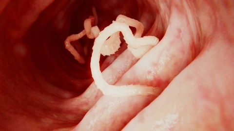 Tapeworm in the intestines, animation Stock Footage 105266339