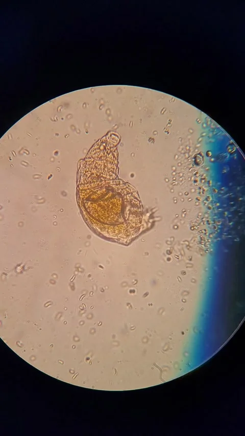 A tardigrad under microscope Vídeos de archivo 331517081