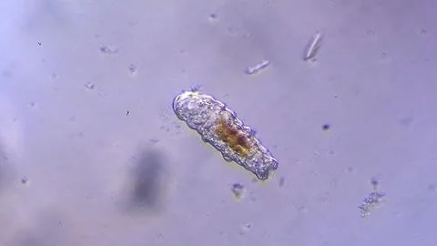 Tardigrade microorganism viewed under microscope Stock Photos