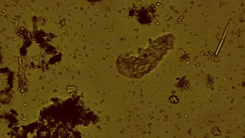 Tardigrade or water bear under microscope Stock Footage 220085487