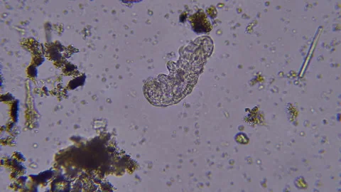 Tardigrade Under The Microscope. Water bear or Moss Piglet. Stock Footage 308195553
