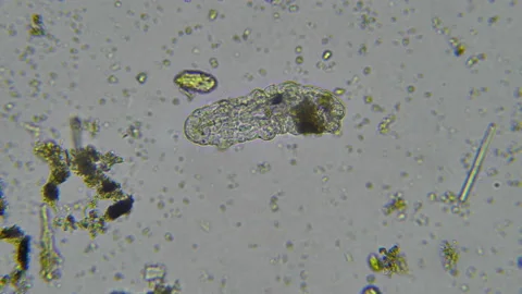 Tardigrade - Water Bear - 2 Stock Footage 141533643