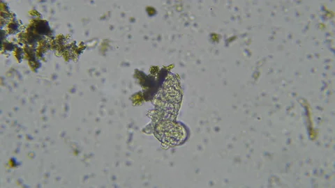 Tardigrade - Water Bear microscopy on moss fragments - 4K Stock Footage 141533666
