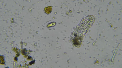 Tardigrade - Water Bear - microscopy on moss fragments - 4K Stock Footage 141533681