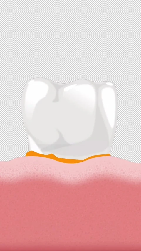 Tartar Formation Concept Vertical 스톡 동영상 227761227