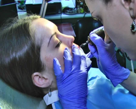 Tattooing of Lips 13 스톡 동영상 35016437