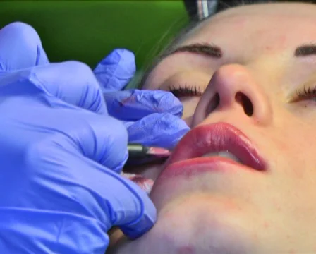 Tattooing of Lips 17 Stock Footage 35016509
