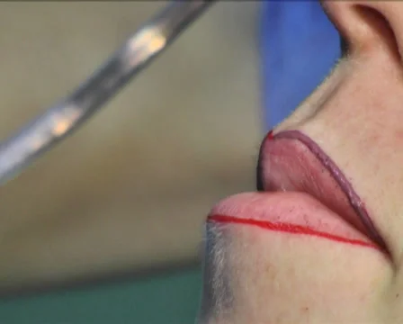 Tattooing of Lips 8 Stock Footage 35016121