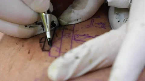 Tattooing Procedure 스톡 동영상 66275158