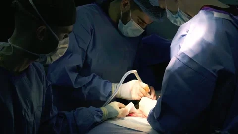 A team of doctors - surgeons performing a surgical operation 库存影片 270451652