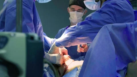 A team of doctors - surgeons performing a surgical operation 库存影片 270452243