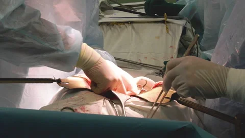 Team of professional multi-race doctors operating surgery in hospital room Stock Footage 162561578