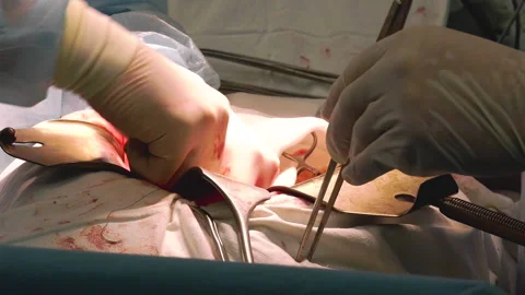 Team of professional multi-race doctors operating surgery in hospital room Stock-Footage 162562107